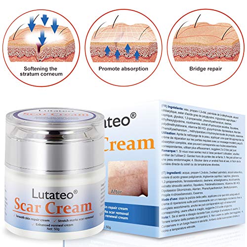 Cicatrices Crema, Crema Cicatriz, Cicatrices Tratamiento,Anti Acné Crema Reparadora Para Quemaduras,Cara Y Cuerpo, Utilízala en Cualquier Parte del Cuerpo