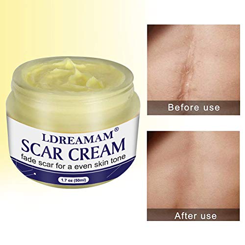 Cicatrices Crema,Crema Cicatriz,ReparacióN De La Piel Crema,Cicatrices Tratamiento,Anti Acné Crema Reparadora Para Quemaduras,Cara Y Cuerpo,Utilízala en Cualquier Parte del Cuerpo