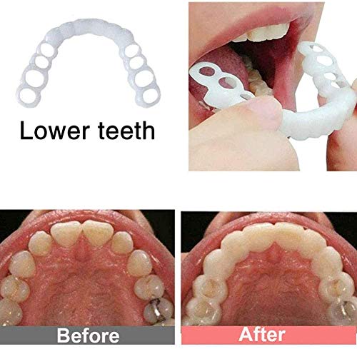 Los apoyos instantánea carillas dentaduras, dentaduras postizas Instant Cover Sonrisa Superior e Inferior cómodo Snap en los Dientes Falsos Dientes Portada ficticia,2pair