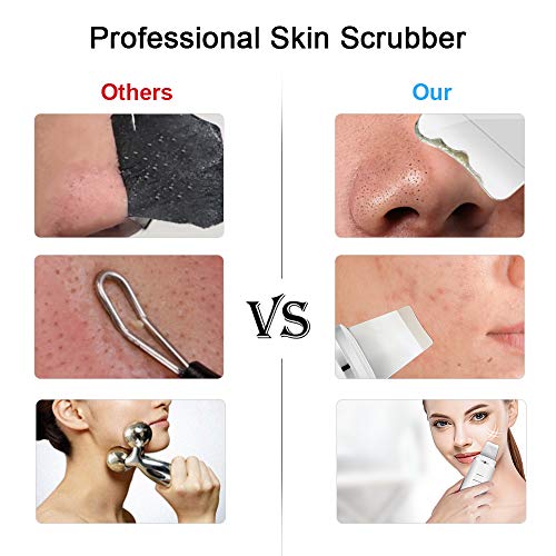 Skin Scrubber Facial, HailiCare 3-in-1 Dispositivo Ultrasónico Limpieza de la Piel Facial para Limpieza Profunda, Tratamiento de Exfoliación Hidratante y Lifting Facial, Carga USB, 3 Modos Blanco