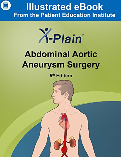 X-Plain ® Abdominal Aortic Aneurysm Surgery (English Edition)