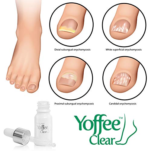 Yoffee - Yoffee Clear - Purity Nail - Antibacteriano y antiséptico, Tratamiento de Uñas de los hongos, Apto para dedos y pedicura, con Árbol de Té y Aceite de Argán (10ml)